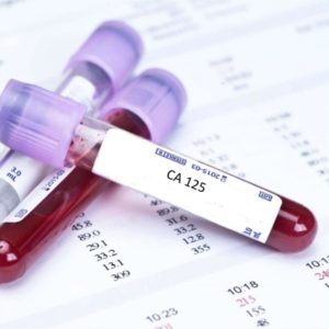 آزمایش خون ca 125